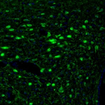 Calretinin Antibody in Immunohistochemistry (Paraffin) (IHC (P))