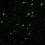 Calretinin Antibody in Immunohistochemistry (Paraffin) (IHC (P))