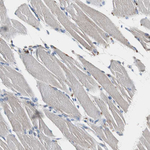 Calretinin Antibody in Immunohistochemistry (Paraffin) (IHC (P))