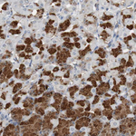 Calretinin Antibody in Immunohistochemistry (Paraffin) (IHC (P))