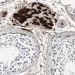 Calretinin Antibody in Immunohistochemistry (Paraffin) (IHC (P))