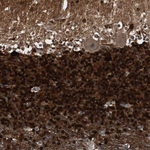 Calretinin Antibody in Immunohistochemistry (Paraffin) (IHC (P))