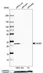 Calretinin Antibody in Western Blot (WB)