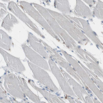 Calretinin Antibody in Immunohistochemistry (Paraffin) (IHC (P))