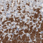 Calretinin Antibody in Immunohistochemistry (Paraffin) (IHC (P))