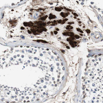 Calretinin Antibody in Immunohistochemistry (Paraffin) (IHC (P))