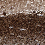 Calretinin Antibody in Immunohistochemistry (Paraffin) (IHC (P))