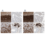 Calretinin Antibody in Immunohistochemistry (Paraffin) (IHC (P))