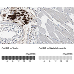 Calretinin Antibody in Immunohistochemistry (Paraffin) (IHC (P))