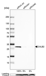 Calretinin Antibody in Western Blot (WB)