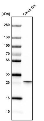 Calretinin Antibody in Western Blot (WB)