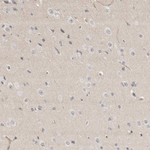 NFkB p50 Antibody in Immunohistochemistry (Paraffin) (IHC (P))