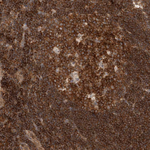 NFkB p50 Antibody in Immunohistochemistry (Paraffin) (IHC (P))