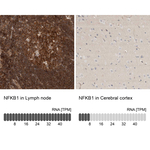 NFkB p50 Antibody in Immunohistochemistry (Paraffin) (IHC (P))
