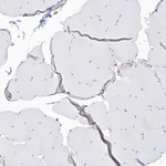 PDIA6 Antibody in Immunohistochemistry (Paraffin) (IHC (P))