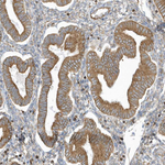 PDIA6 Antibody in Immunohistochemistry (Paraffin) (IHC (P))