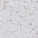 PDIA6 Antibody in Immunohistochemistry (Paraffin) (IHC (P))