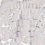 ERp57 Antibody in Immunohistochemistry (Paraffin) (IHC (P))