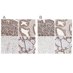 ERp57 Antibody in Immunohistochemistry (Paraffin) (IHC (P))