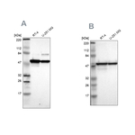 ERp57 Antibody in Western Blot (WB)