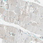 GRP94 Antibody in Immunohistochemistry (Paraffin) (IHC (P))