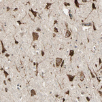 GRP94 Antibody in Immunohistochemistry (Paraffin) (IHC (P))