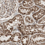 GRP94 Antibody in Immunohistochemistry (Paraffin) (IHC (P))