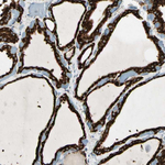 GRP94 Antibody in Immunohistochemistry (Paraffin) (IHC (P))
