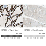 GRP94 Antibody in Immunohistochemistry (Paraffin) (IHC (P))
