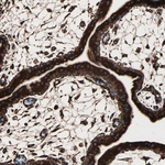 GRP94 Antibody in Immunohistochemistry (Paraffin) (IHC (P))