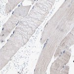GRP94 Antibody in Immunohistochemistry (Paraffin) (IHC (P))