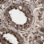 GRP94 Antibody in Immunohistochemistry (Paraffin) (IHC (P))