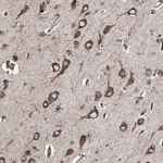 GRP94 Antibody in Immunohistochemistry (Paraffin) (IHC (P))