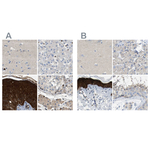 Maspin Polyclonal Antibody
