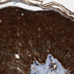 Maspin Antibody in Immunohistochemistry (Paraffin) (IHC (P))