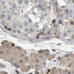 Maspin Antibody in Immunohistochemistry (Paraffin) (IHC (P))