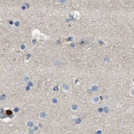 Maspin Antibody in Immunohistochemistry (Paraffin) (IHC (P))
