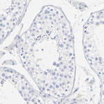 NGAL Antibody in Immunohistochemistry (Paraffin) (IHC (P))