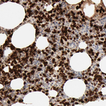 NGAL Antibody in Immunohistochemistry (Paraffin) (IHC (P))