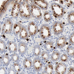 NGAL Antibody in Immunohistochemistry (Paraffin) (IHC (P))