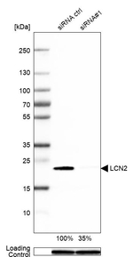 NGAL Antibody in Western Blot (WB)