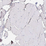 IDH1 Antibody in Immunohistochemistry (Paraffin) (IHC (P))