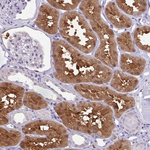 IDH1 Antibody in Immunohistochemistry (Paraffin) (IHC (P))