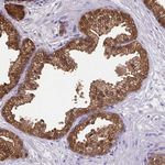 IDH1 Antibody in Immunohistochemistry (Paraffin) (IHC (P))