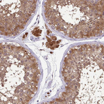 IDH1 Antibody in Immunohistochemistry (Paraffin) (IHC (P))