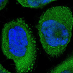 Annexin A1 Polyclonal Antibody