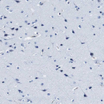 Annexin A1 Antibody in Immunohistochemistry (Paraffin) (IHC (P))
