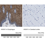 Annexin A1 Antibody in Immunohistochemistry (Paraffin) (IHC (P))