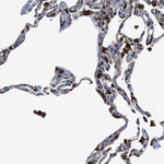 Annexin A1 Antibody in Immunohistochemistry (Paraffin) (IHC (P))