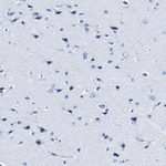 Annexin A1 Antibody in Immunohistochemistry (Paraffin) (IHC (P))